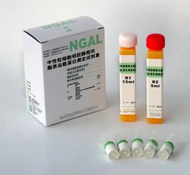 中性粒細胞明膠酶相關脂質運載蛋白( NAGL )臨床應用